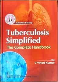 Tuberculosis Simplified: The Complete Handbook