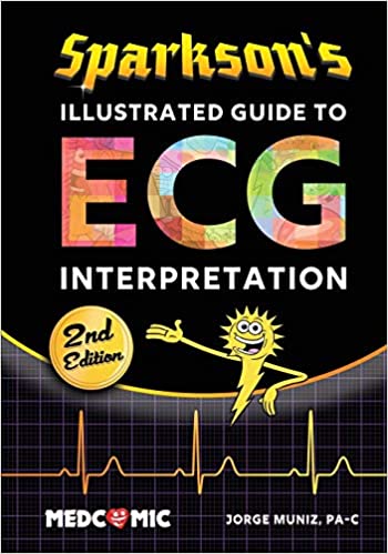 Sparkson’s Illustrated Guide to ECG Interpretation, 2nd Edition