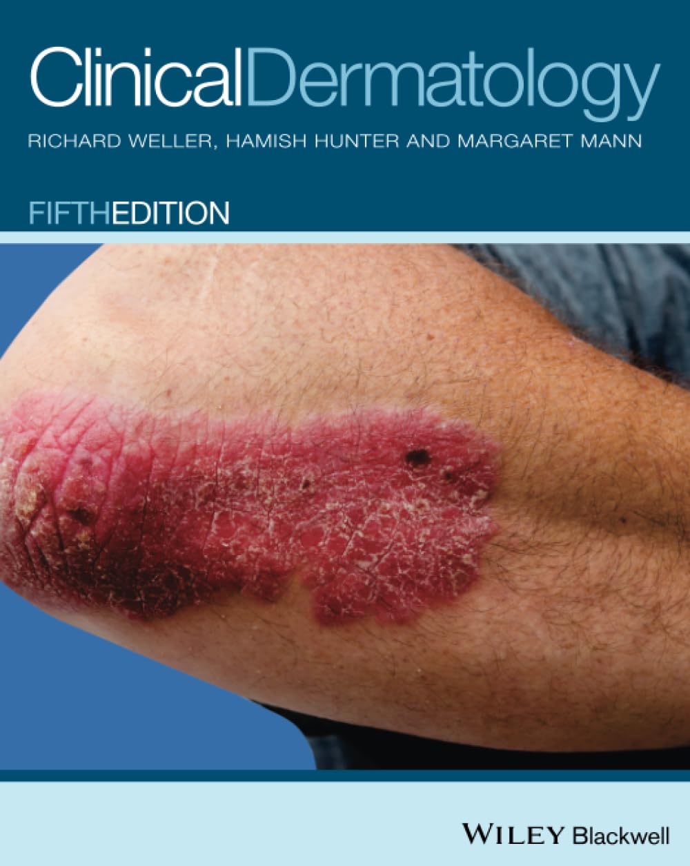 Clinical Dermatology, 5th Edition