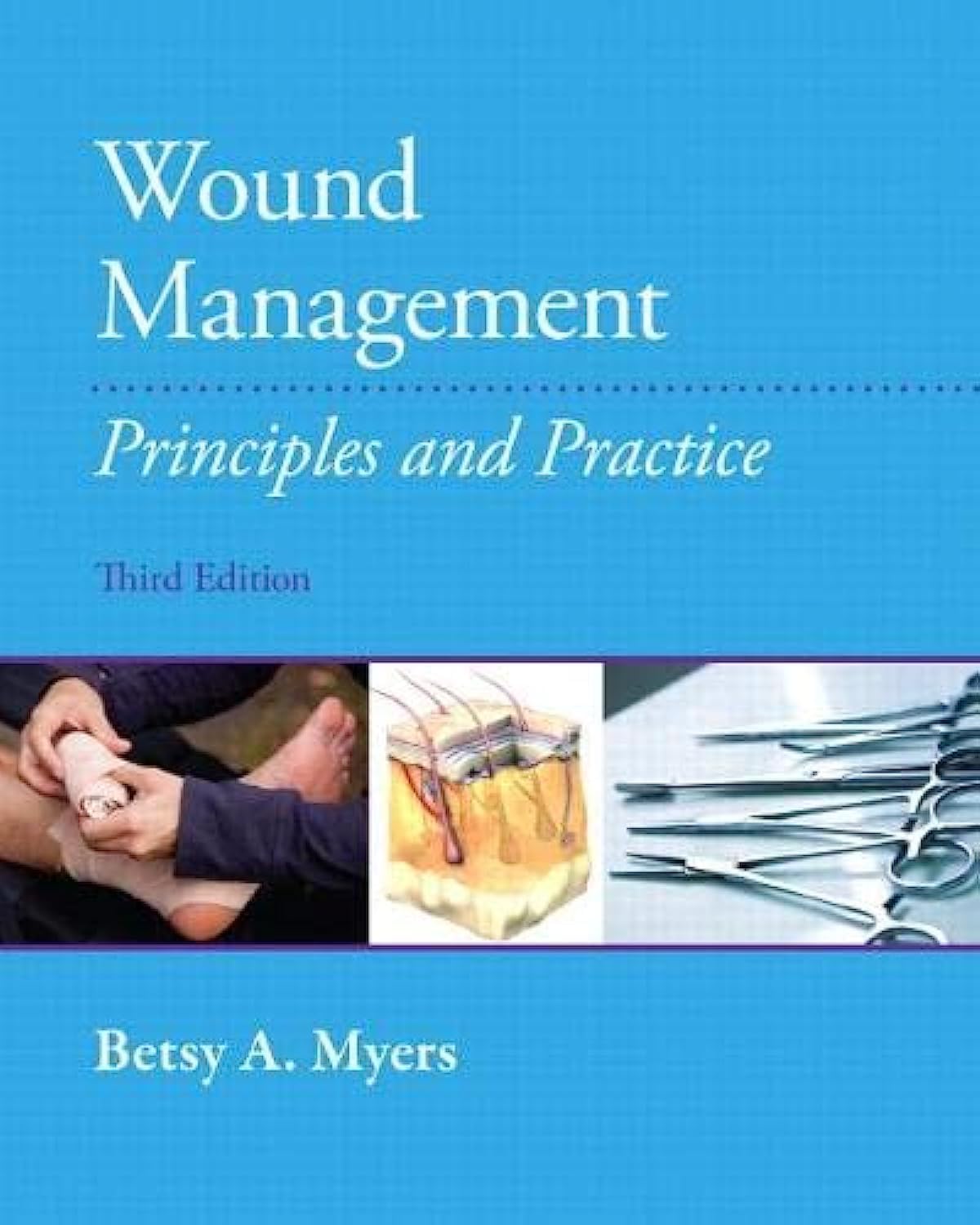 Wound Management: Principles and Practice, 3th Edition