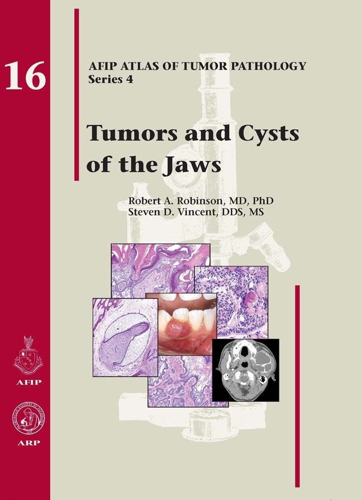 Tumors and Cysts of the Jaws