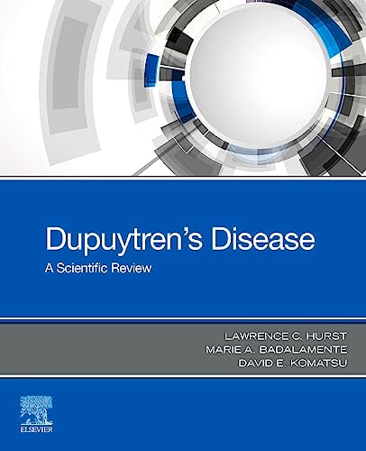 Dupuytren’s Disease: A Scientific Review