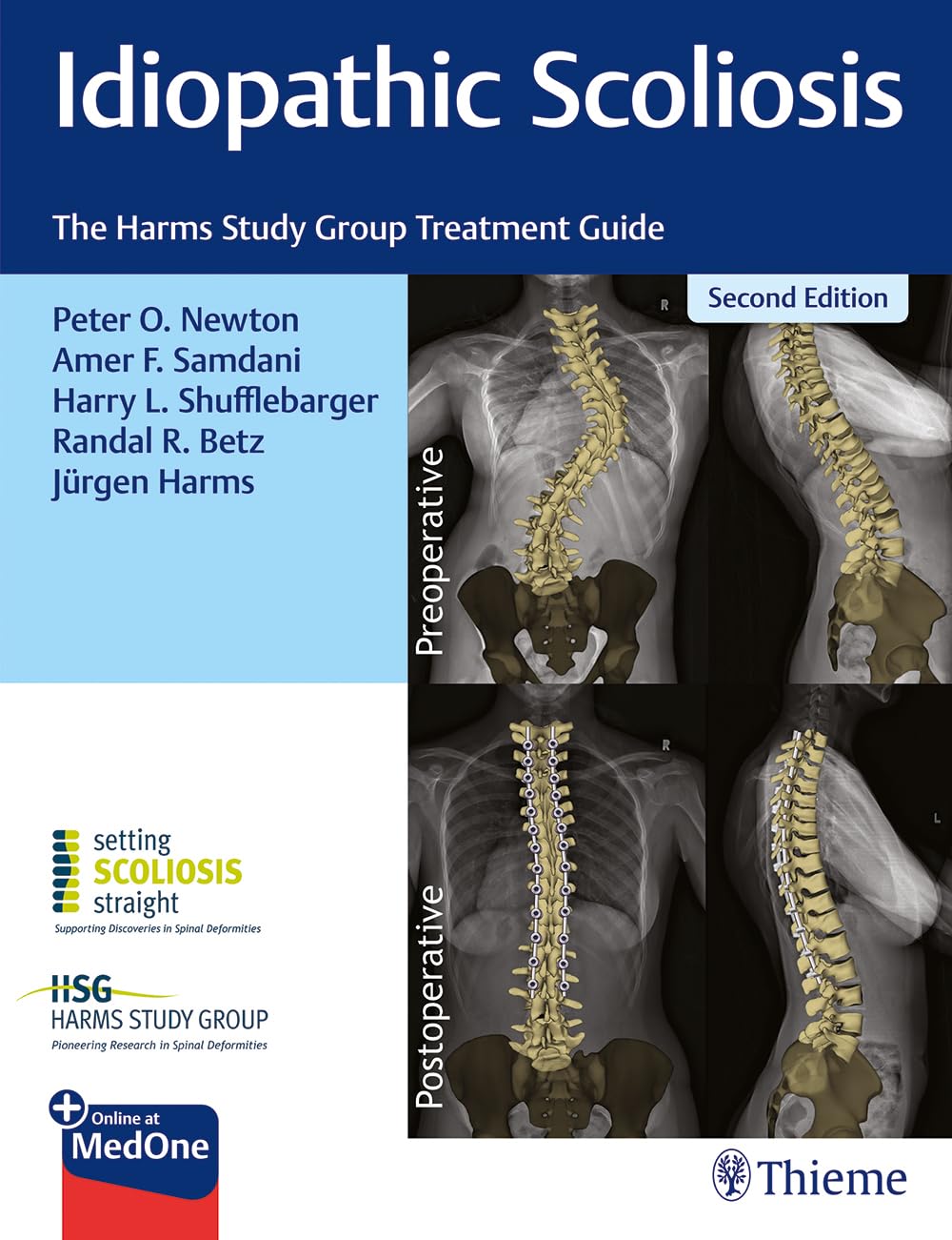 Idiopathic Scoliosis: The Harms Study Group Treatment Guide, 2nd edition