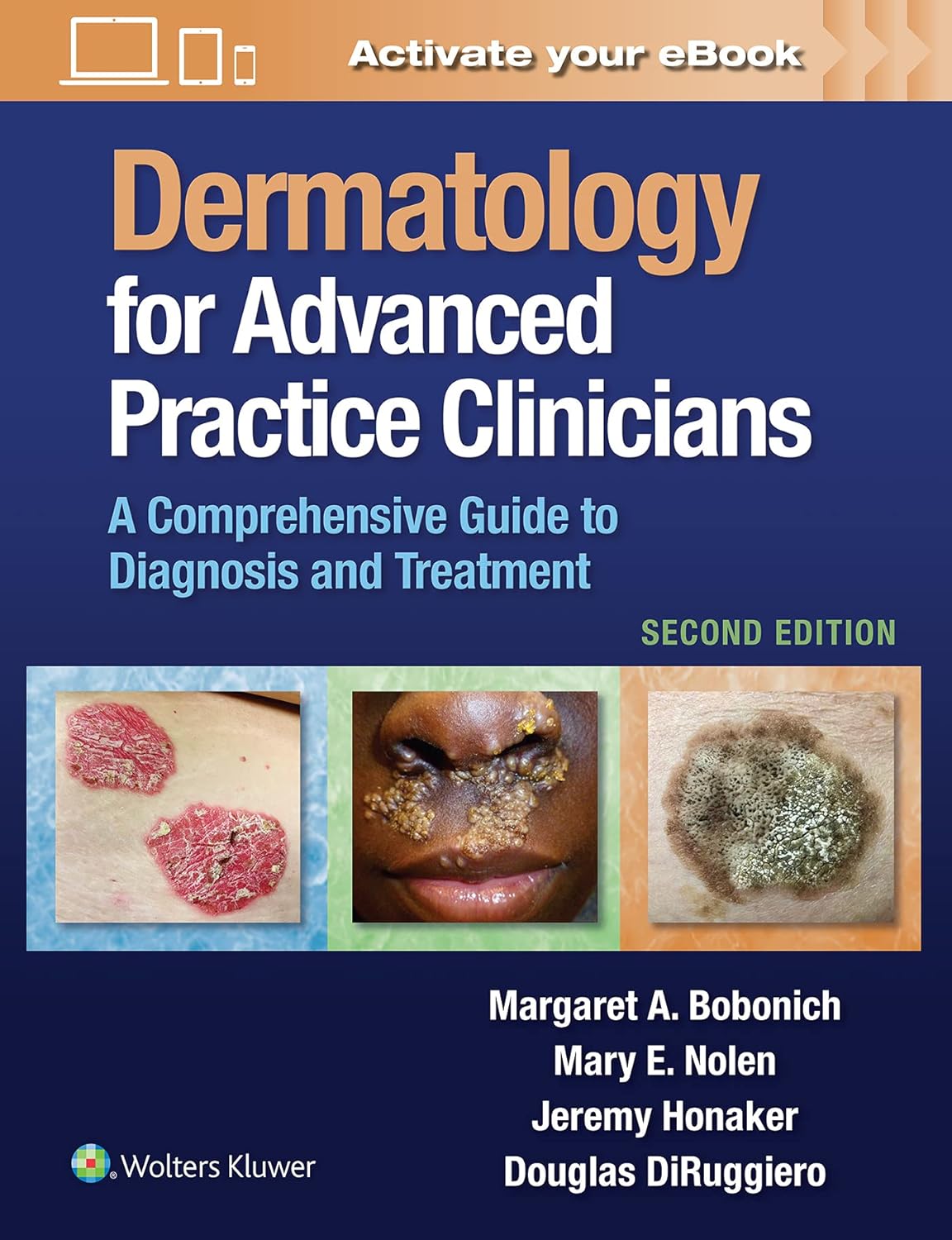 Dermatology for Advanced Practice Clinicians: A Practical Approach to Diagnosis and Management, 2nd edition