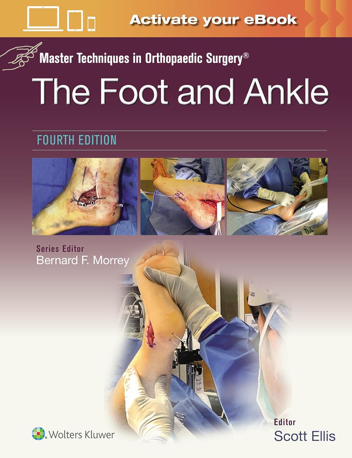 Master Techniques in Orthopaedic Surgery: The Foot and Ankle, 4th Edition (EPUB + Videos)