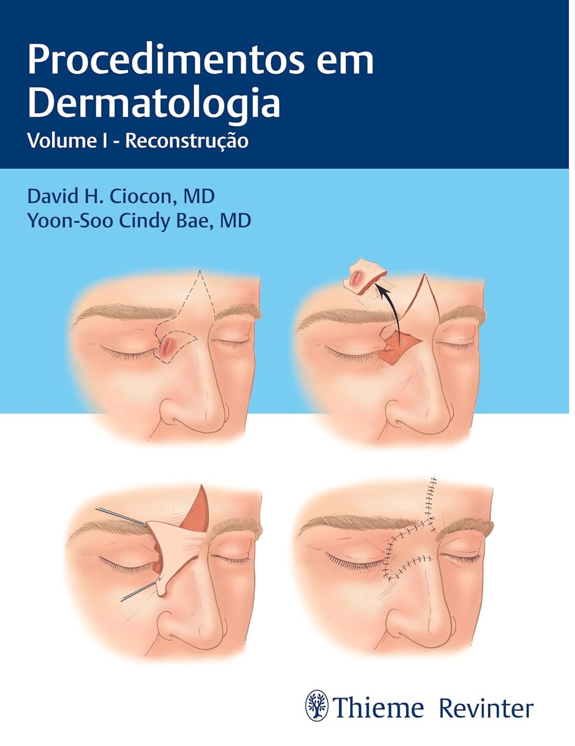 Procedural Dermatology Volume I: Reconstruction: Postresidency and Fellowship Compendium