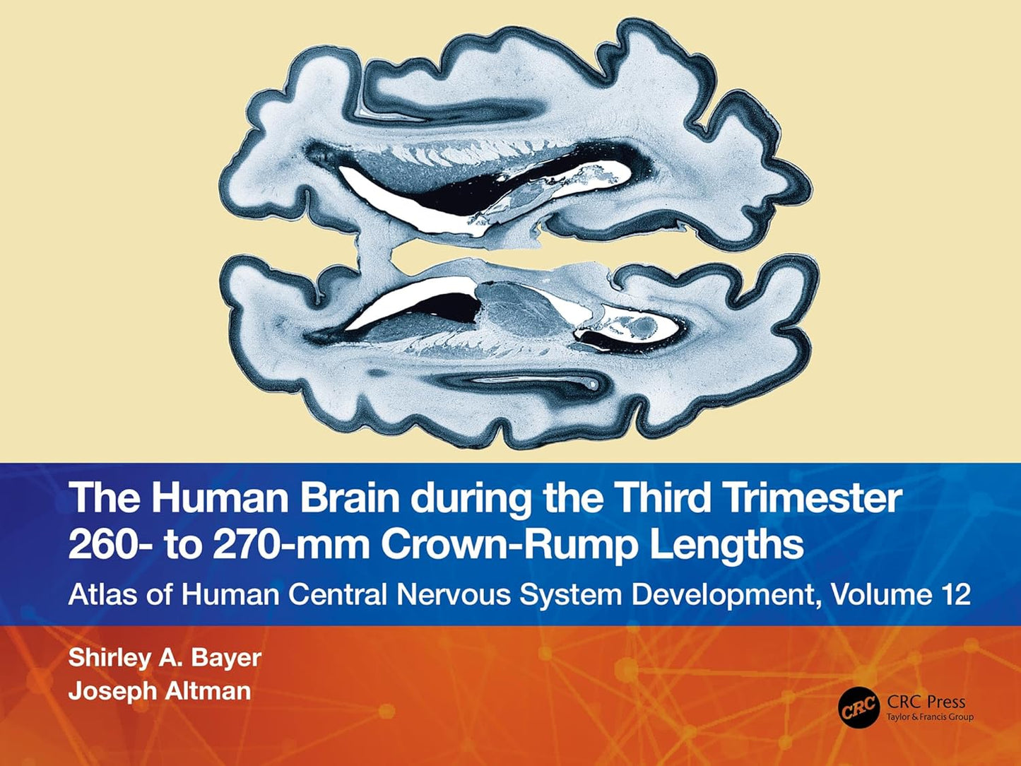 The Human Brain during the Third Trimester 260– to 270–mm Crown-Rump Lengths: Atlas of Central Nervous System Development, Volume 12 (Atlas of Central Nervous System Development, 12)