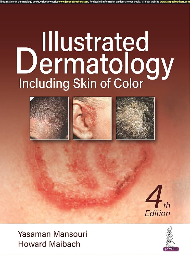 Illustrated Dermatology, 4th Edition