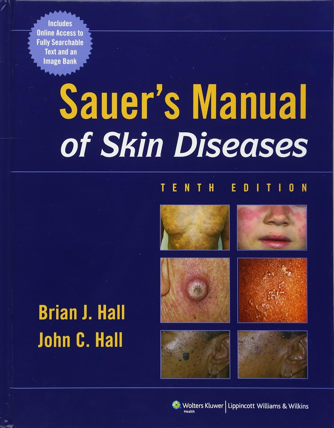 Sauer's Manual of Skin Diseases , 10th Edition