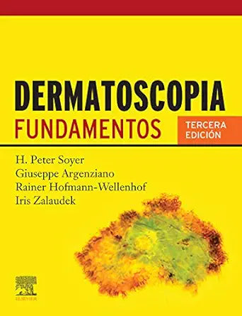 Dermatoscopia: Fundamentos (Spanish Edition), 3rd Edition