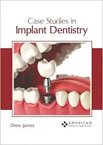 Case Studies in Implant Dentistry