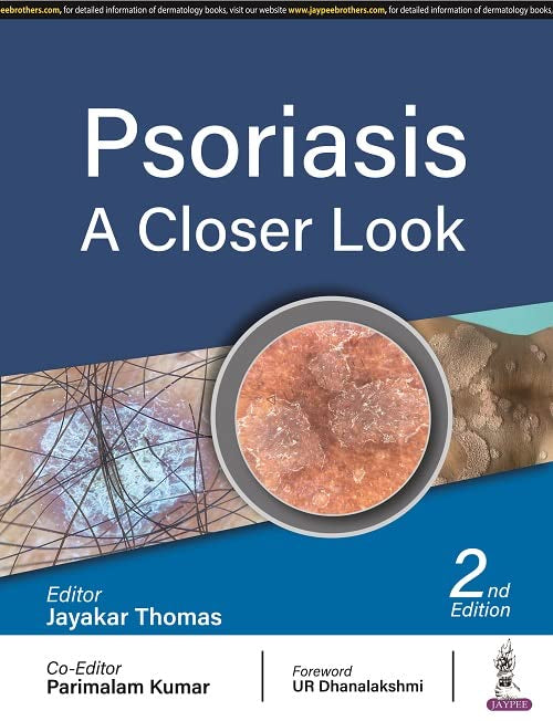 Psoriasis: A Closer Look, 2nd Edition