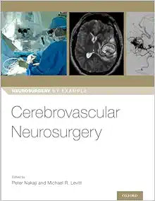 Cerebrovascular Neurosurgery (Neurosurgery by Example)