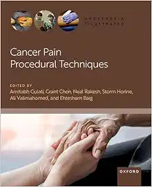 Cancer Pain Procedural Techniques (Anesthesia Illustrated)