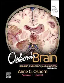 Osborn’s Brain, 3rd edition