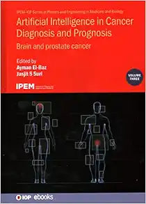 Artificial Intelligence in Cancer Diagnosis and Prognosis: Brain and prostate cancer (Volume 3) (Physics and Engineering in Medicine and Biology, Volume 3)