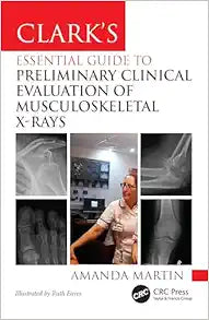 Clark’s Essential Guide to Preliminary Clinical Evaluation of Musculoskeletal X-rays: Evaluating and Commenting on Images (Clark’s Companion Essential Guides)