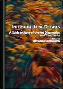 Interstitial Lung Diseases: A Guide to State-of-the-Art Diagnostics and Treatments