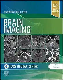 Brain Imaging: Case Review Series, 3rd edition
