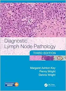 Diagnostic Lymph Node Pathology