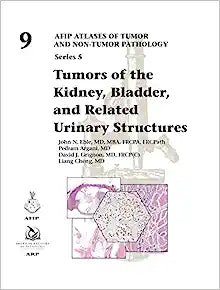 Tumors of the Kidney, Bladder, and Related Urinaray Structures (AFIP Atlases of Tumor and Non-tumor Pathology, Series 5, Volume 9)