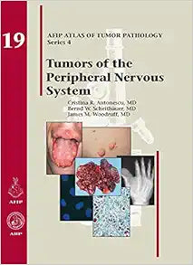 Tumors of the Peripheral Nervous System (AFIP Atlas of Tumor Pathology, Series 4, Fascicle 19)