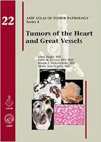 Tumors of the Heart and Great Vessels