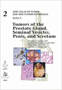 Tumors of the Prostate Gland, Seminal Vesicles, Penis, and Scrotum (AFIP Atlas of Tumor and Non-Tumor Pathology, Series 5, Fascicle 2)