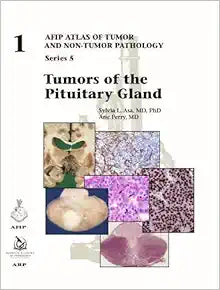 Tumors of the Pituitary Gland (AFIP Atlas of Tumor and Non-Tumor Pathology, Series 5, Fascicle 1)