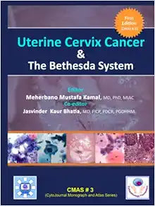 Uterine Cervix Cancer The Bethesda System: CMAS # 3 (CytoJournal Monograph / Atlas Series)