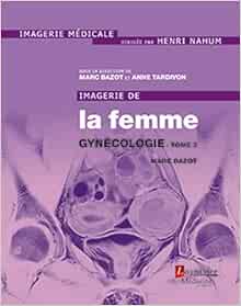Imagerie de la femme : Gynécologie – Tome 2