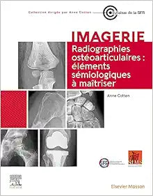Radiographies ostéoarticulaires : éléments sémiologiques à maitriser (French Edition)