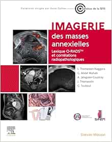 Imagerie des masses annexielles: Lexique O-RADS et corrélations radiopathologiques