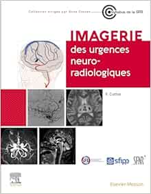 Imagerie des urgences neuroradiologiques