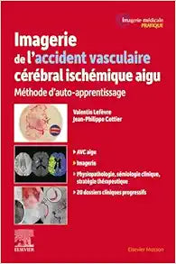 Imagerie de l'accident vasculaire cérébral ischémique aigu: Méthode d'auto-apprentissage