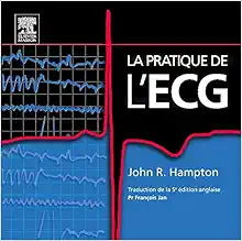 La pratique de l'ECG