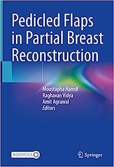 Pedicled Flaps in Partial Breast Reconstruction