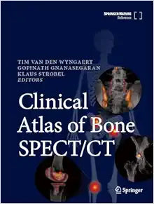 Clinical Atlas of Bone SPECT/CT