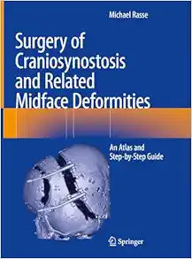 Surgery of Craniosynostosis and Related Midface Deformities: An Atlas and Step-by-Step Guide, 2024th Edition