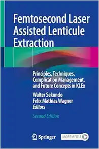 Femtosecond Laser Assisted Lenticule Extraction: Principles, Techniques, Complication Management, and Future Concepts in KLEx, 2nd Edition