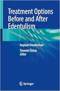 Treatment Options Before and After Edentulism: Implant Overdenture
