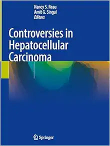 Controversies in Hepatocellular Carcinoma