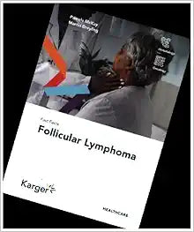 Fast Facts: Follicular Lymphoma