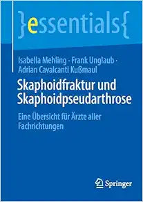 Skaphoidfraktur und Skaphoidpseudarthrose: Eine Übersicht für Ärzte aller Fachrichtungen (essentials) (German Edition)