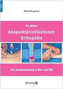 Die besten Akupunkturindikationen Orthopädie