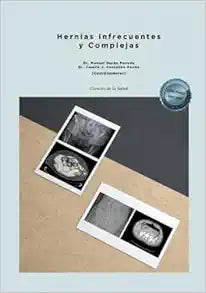 Hernias Infrecuentes y Complejas