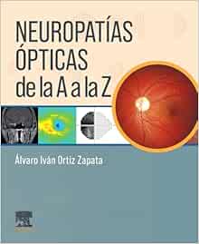 Neuropatías ópticas de la A a la Z