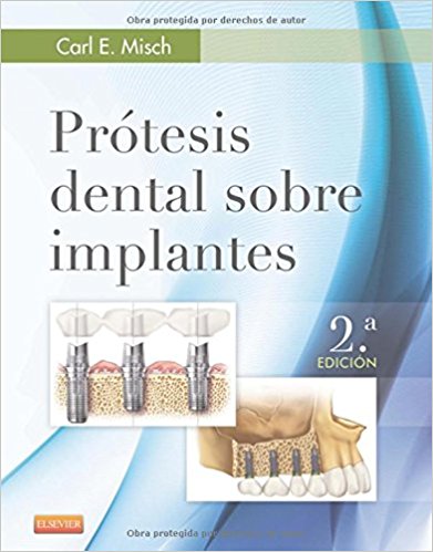 Prótesis dental sobre implantes , 2e