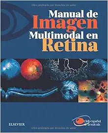 Manual de imagen multimodal en retina