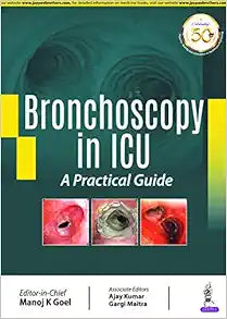 Bronchoscopy in ICU: A Practical Guide